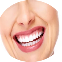 Lentes de Contato Dental